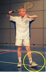 high serve toe